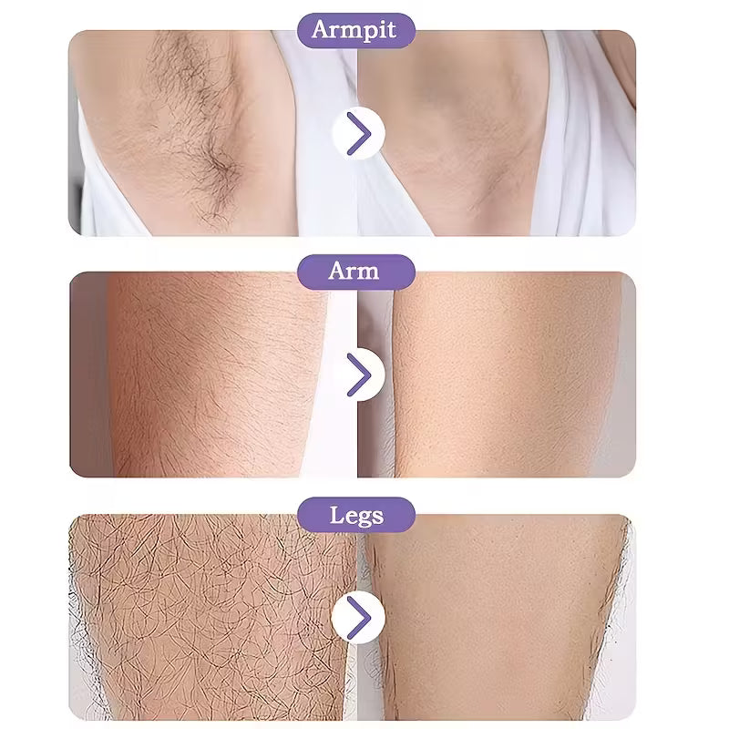 Permanent Hair Removal — Smooth Skin Without Pain