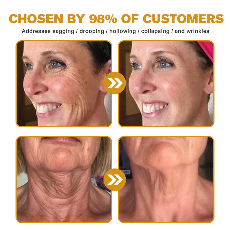 👨‍⚕️Botox Bee Venom Wrinkle Removal Cream