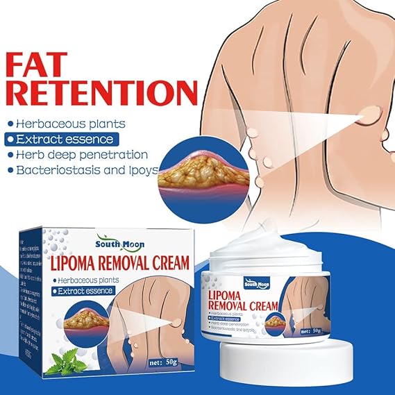 LIPOMA REMOVAL SPRAY (IMPORTED)