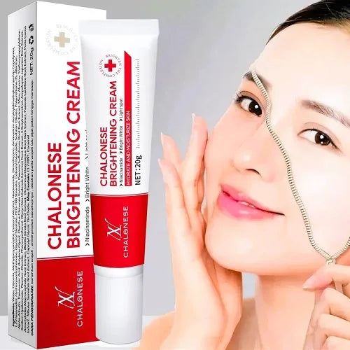 Chalonese Whitening Freckle Cream Remove Dark Spots Anti Freckle Cream